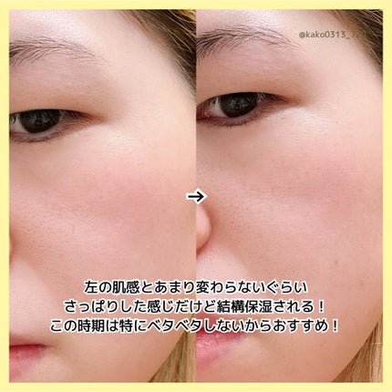 ノスカナイン トラブル セラム/FATION/美容液を使ったクチコミ(6枚目)