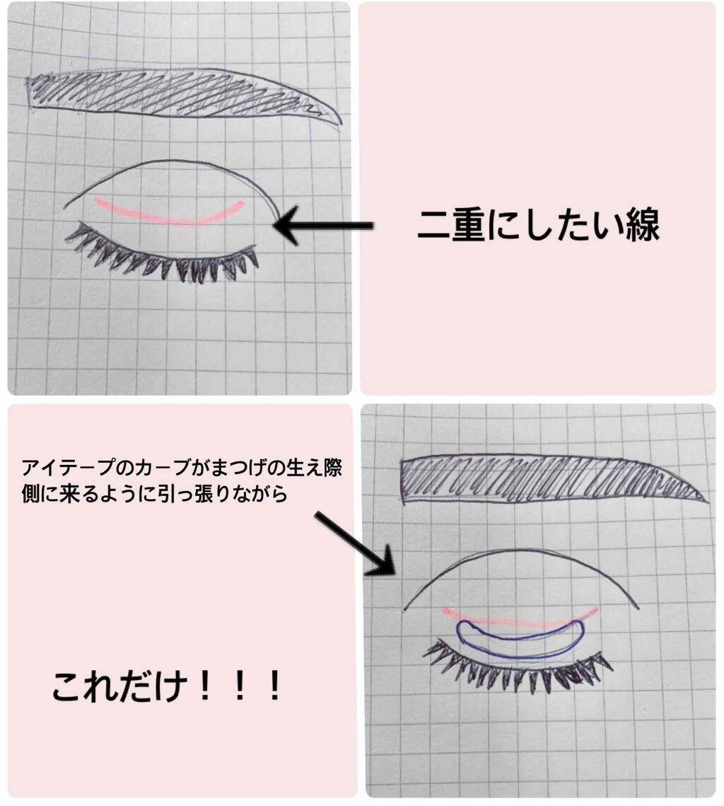 アイビューティー フィクサー WP/アストレア ヴィルゴ/二重まぶた用アイテムを使ったクチコミ（3枚目）