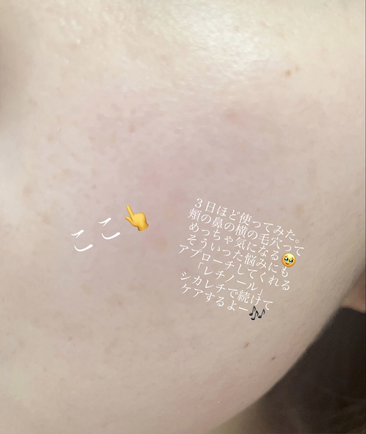 CICA クリーム/VT/フェイスクリームを使ったクチコミ（3枚目）