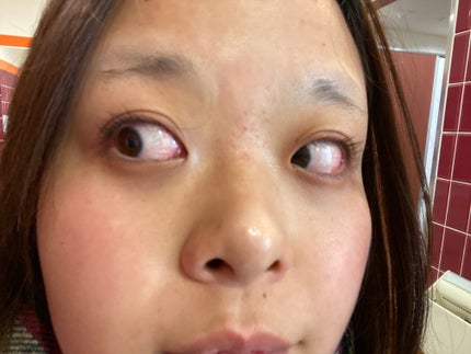 アイラッシュカーラーワイドサイズ/matsukiyo/ビューラーを使ったクチコミ(3枚目)