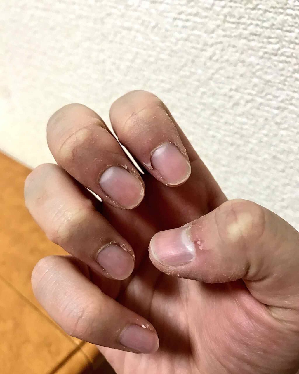 新ユースキンA/ユースキン/ハンドクリームを使ったクチコミ（3枚目）