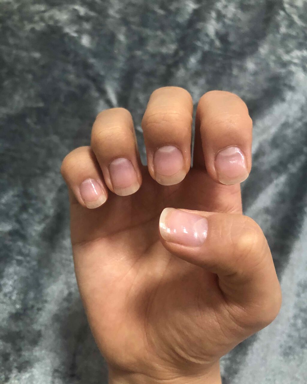 ネイルベッドオイル/アンドネイル/ネイルオイル・トリートメントを使ったクチコミ(2枚目)