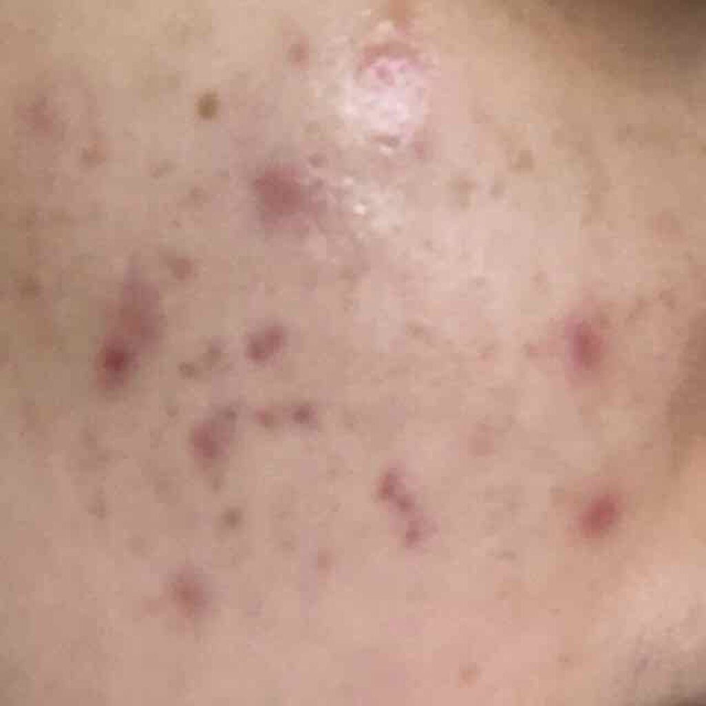 キールズ DS クリアリーブライト エッセンス[医薬部外品]/Kiehl's/美容液を使ったクチコミ（3枚目）