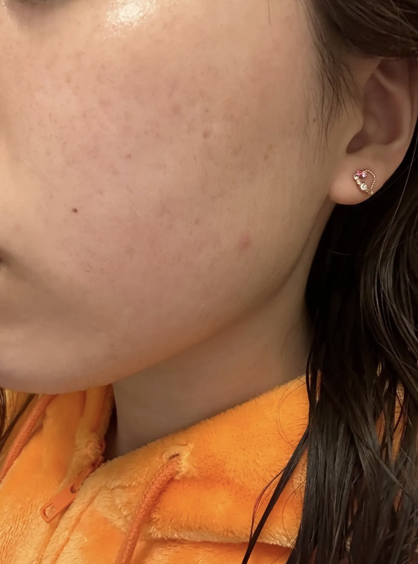 リアルカロテンブレミッシュクリアビタパッド/APRILSKIN/トナーパッドを使ったクチコミ（3枚目）