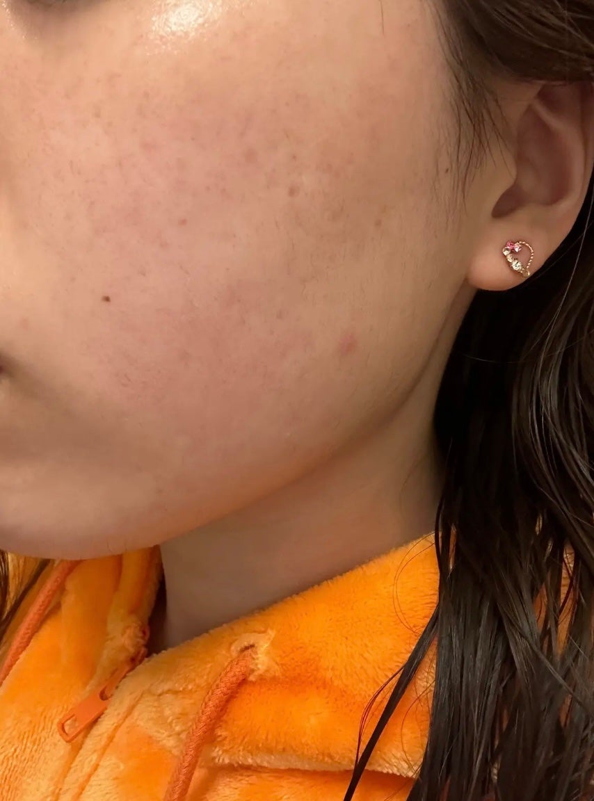 VC100エッセンスローション EX/ドクターシーラボⓇ/化粧水を使ったクチコミ(3枚目)