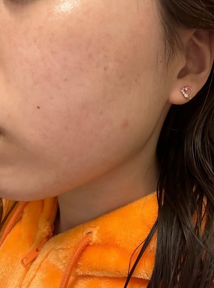 VC100エッセンスローション EX/ドクターシーラボⓇ/化粧水を使ったクチコミ(3枚目)