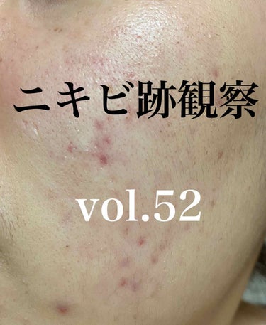 敏感肌用薬用美白美容液/無印良品/美容液を使ったクチコミ（1枚目）