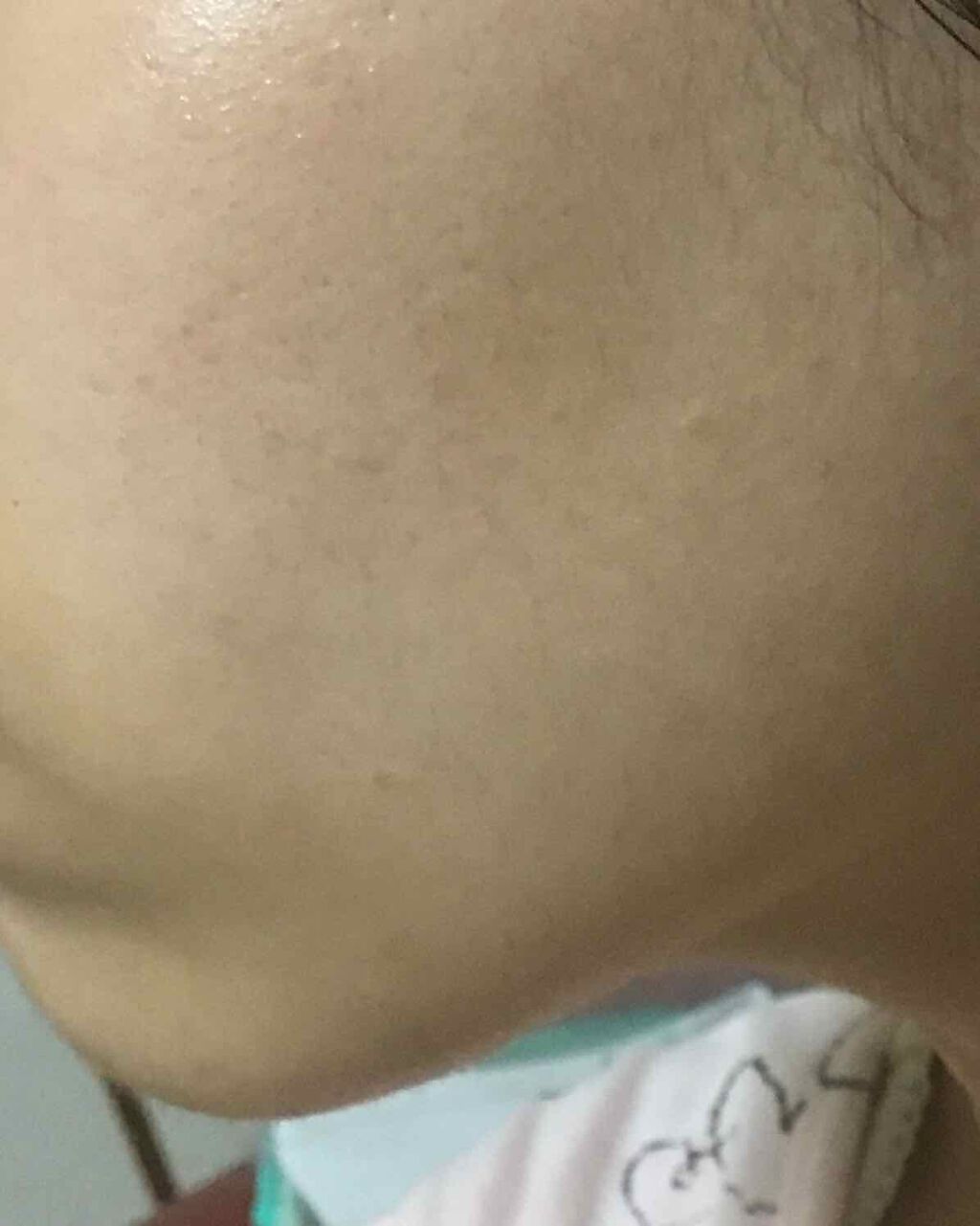 ファンケル エンリッチプラス 化粧液Ⅱ しっとり ＜医薬部外品＞のクチコミ「✋✋✋2枚目肌の写真注意です✋✋✋

この間の日本酒の乳液に引き継いで、FANCLの化粧液の使.....」（2枚目）