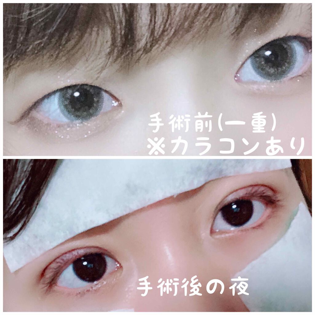 Sakuð· on LIPS ãåæ²¡èšé²Part2ðåæ²¡æ¥èšããŒã2ã§ã2æç®ã«å没åãšå没1..ãïŒ2æç®ïŒ