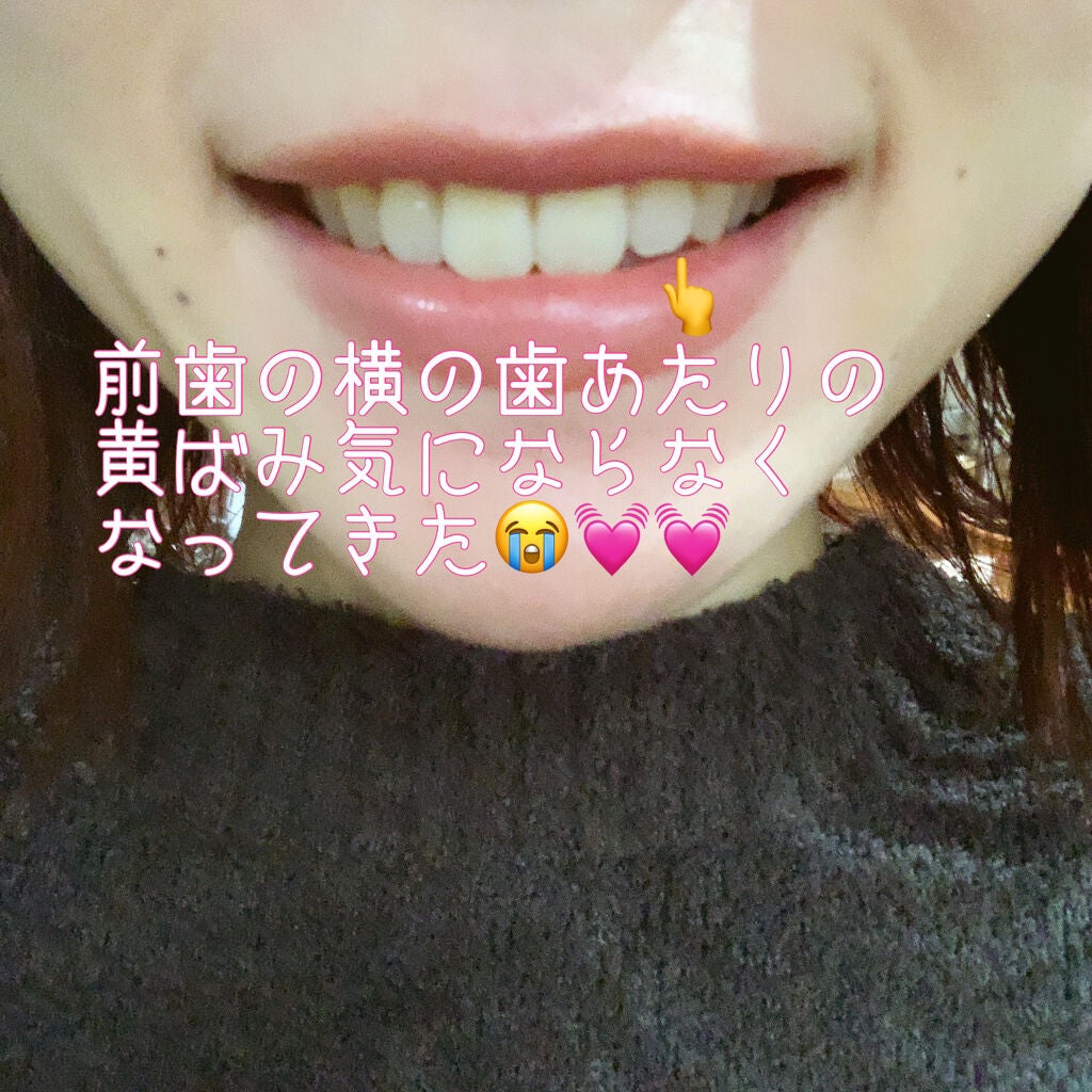 はみがき デイリータイプ/セッチマ/歯磨き粉を使ったクチコミ(2枚目)