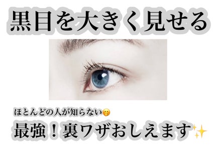 スマイルホワイティエ(医薬品)/ライオン/その他を使ったクチコミ(1枚目)