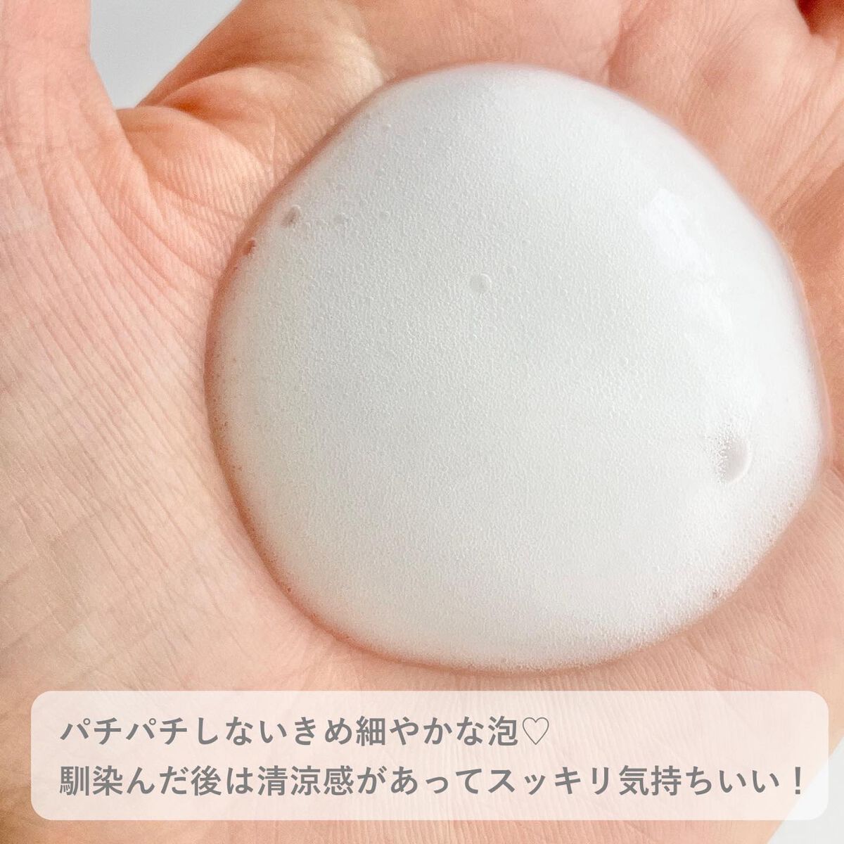 アクア チャージ ムース/ines/頭皮ローションを使ったクチコミ（2枚目）