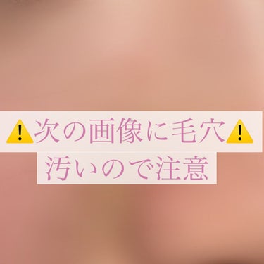 薬用クリアローション とてもしっとり/ネイチャーコンク/拭き取り化粧水を使ったクチコミ（1枚目）