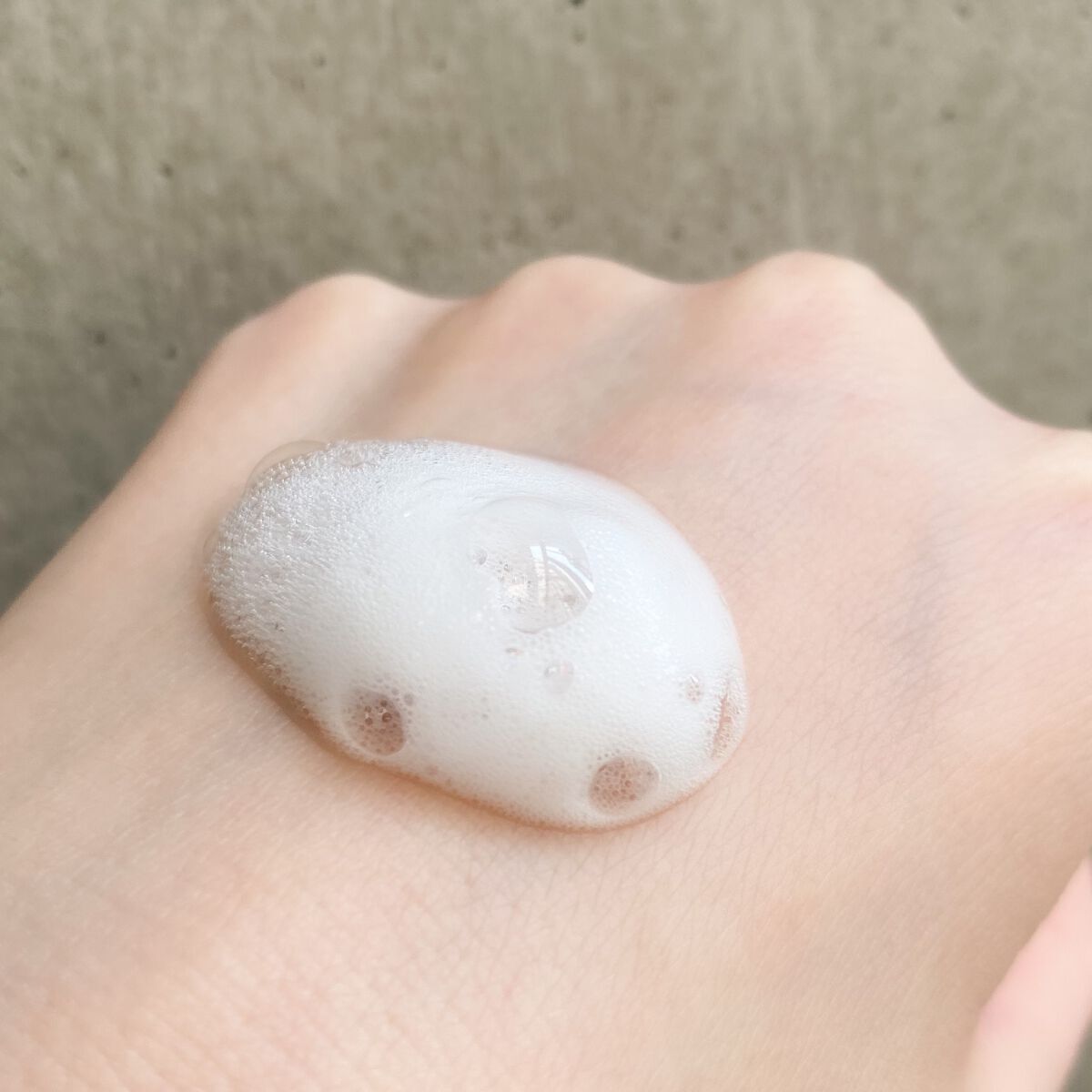 フェルゼアプレミアム 薬用泡の化粧水/フェルゼア/化粧水を使ったクチコミ(2枚目)