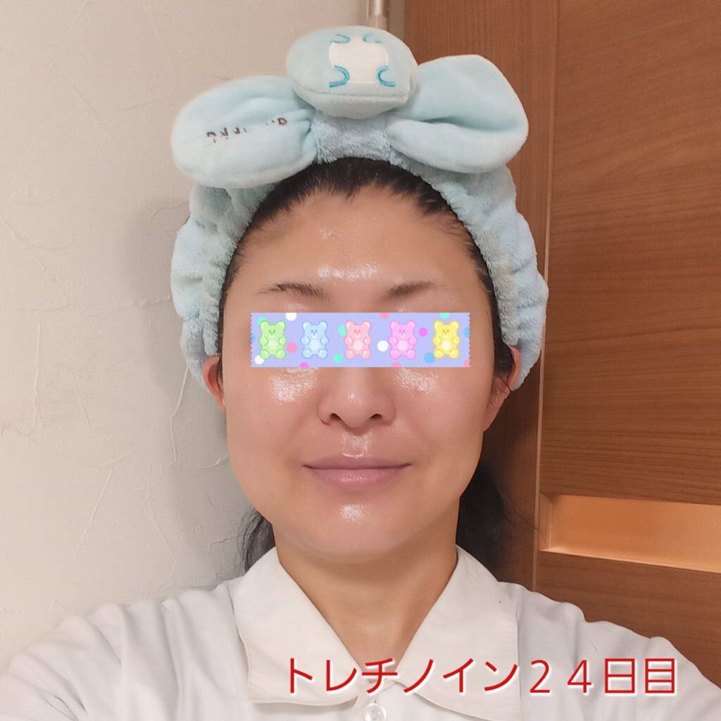 マキロンs （医薬品）/マキロン/その他を使ったクチコミ（1枚目）