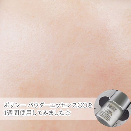 ポリシー パウダーエッセンス CO/ポリシー化粧品/美容液を使ったクチコミ(5枚目)