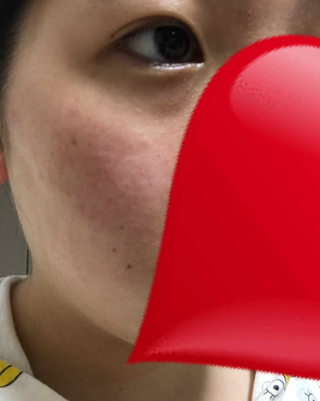 薬用 しみ 集中対策 美容液/メラノCC/美容液を使ったクチコミ（3枚目）