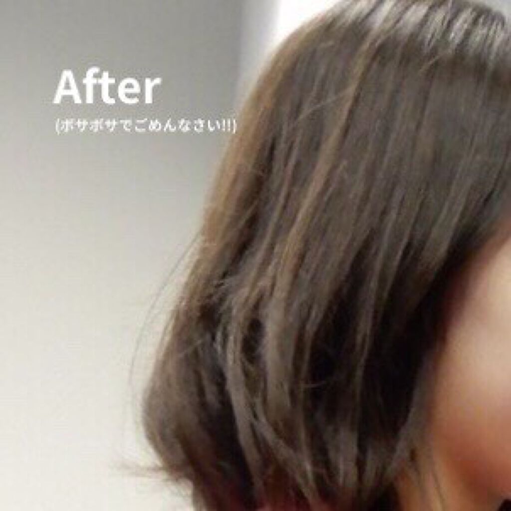 ヘアケア方法 オキシドール 医薬品 日本薬局方の使い方 効果 初投稿です 今 By チョレギ 乾燥肌 10代後半 Lips ヘアケア方法 オキシドール 医薬品 日本薬局方の使い方 効果 初投稿です 今 By チョレギ 乾燥肌 10代後半 Lips