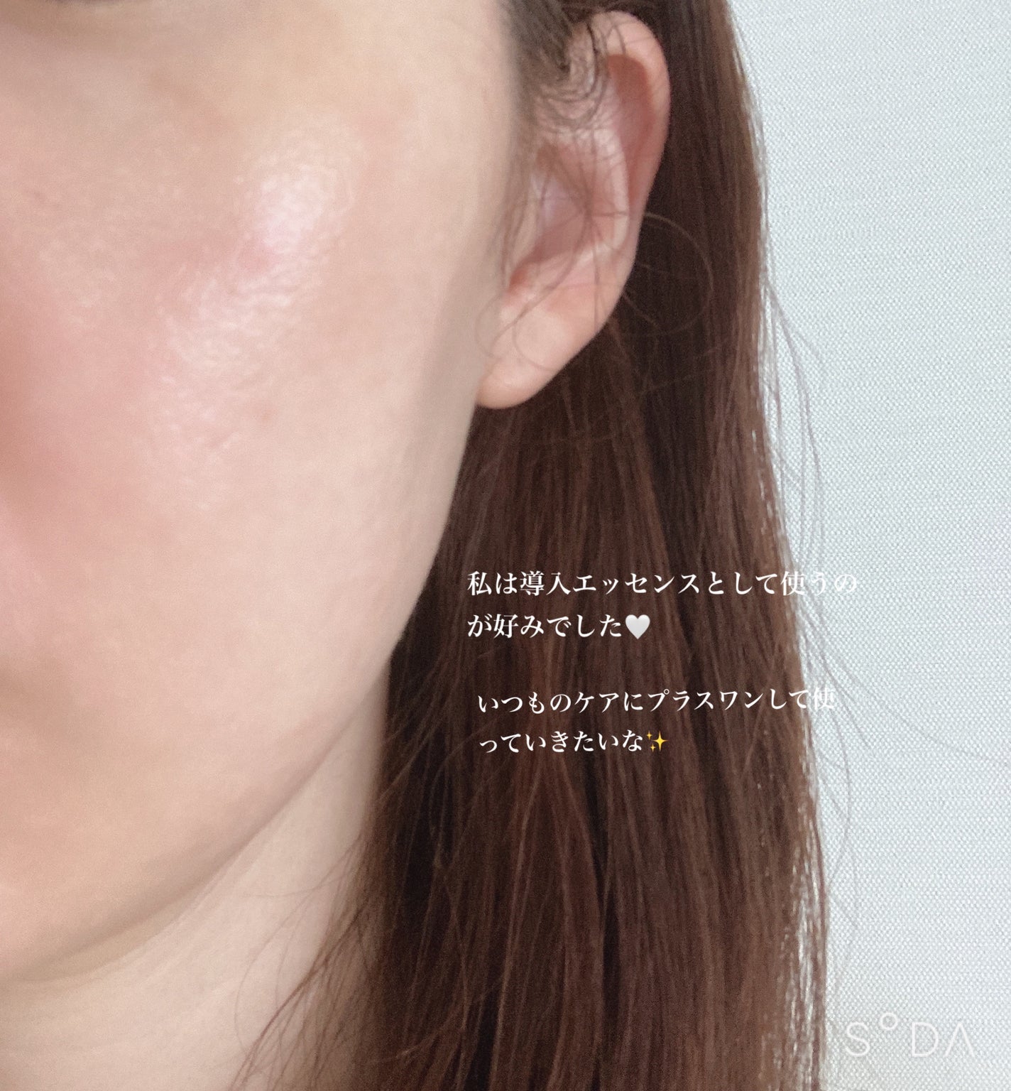 5G ESSENCE LOTION/CEMOY/化粧水を使ったクチコミ(8枚目)