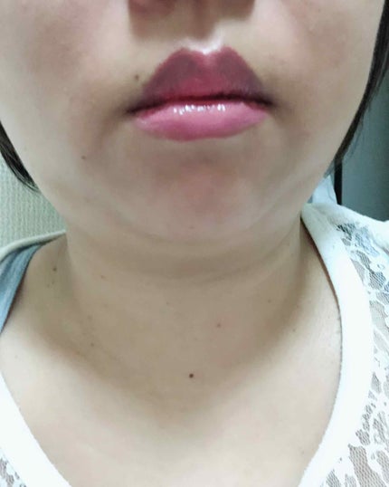 ディオール アディクト ラッカー スティック/Dior/口紅を使ったクチコミ(2枚目)