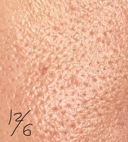 ガラクナイアシン2.0エッセンス/manyo/美容液を使ったクチコミ(6枚目)