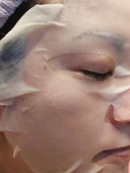 スキントラブルケア マスク/アルージェ/シートマスク・パックを使ったクチコミ(5枚目)