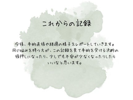 マイクロマスカラ アドバンストフィルム/ヒロインメイク/マスカラを使ったクチコミ(5枚目)