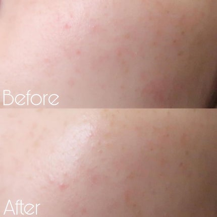 リアルカバーリキッド(セミマット)/KATE/リキッドファンデーションを使ったクチコミ(4枚目)