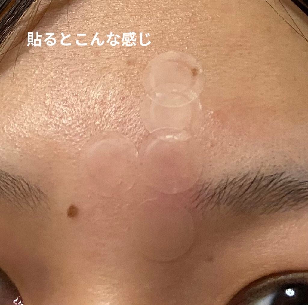 プロCICA クリアスポットパッチ/VT/その他スキンケアを使ったクチコミ(3枚目)