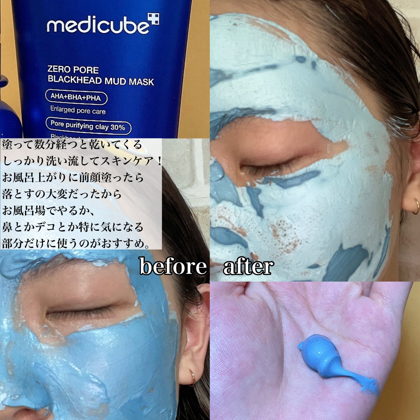 ゼロ毛穴パッド 2.0/MEDICUBE/トナーパッドを使ったクチコミ(4枚目)