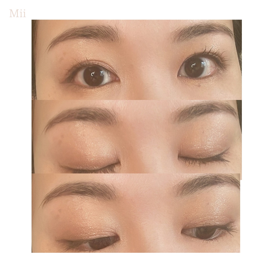 スマイルアップチークスN/コフレドール/パウダーチークを使ったクチコミ（1枚目）