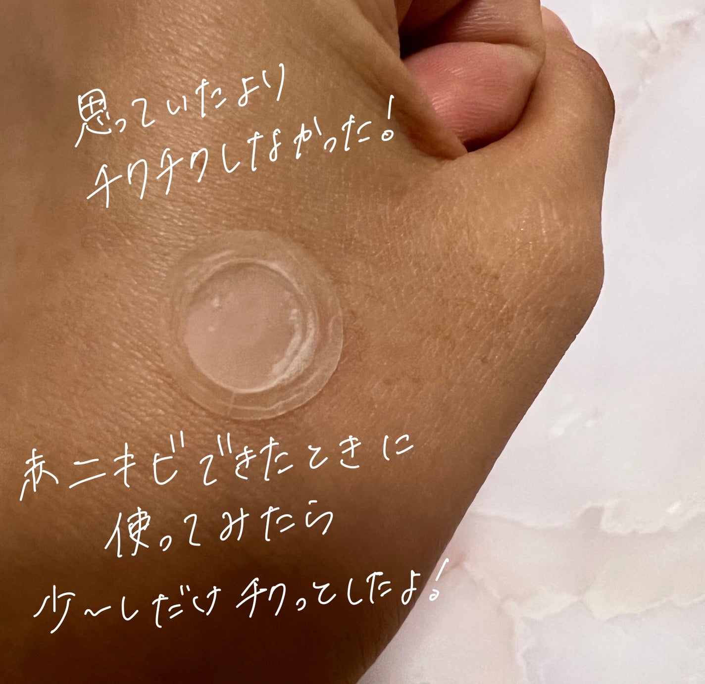 エーキュアショットスポットパッチ/obsero/にきびパッチを使ったクチコミ(4枚目)