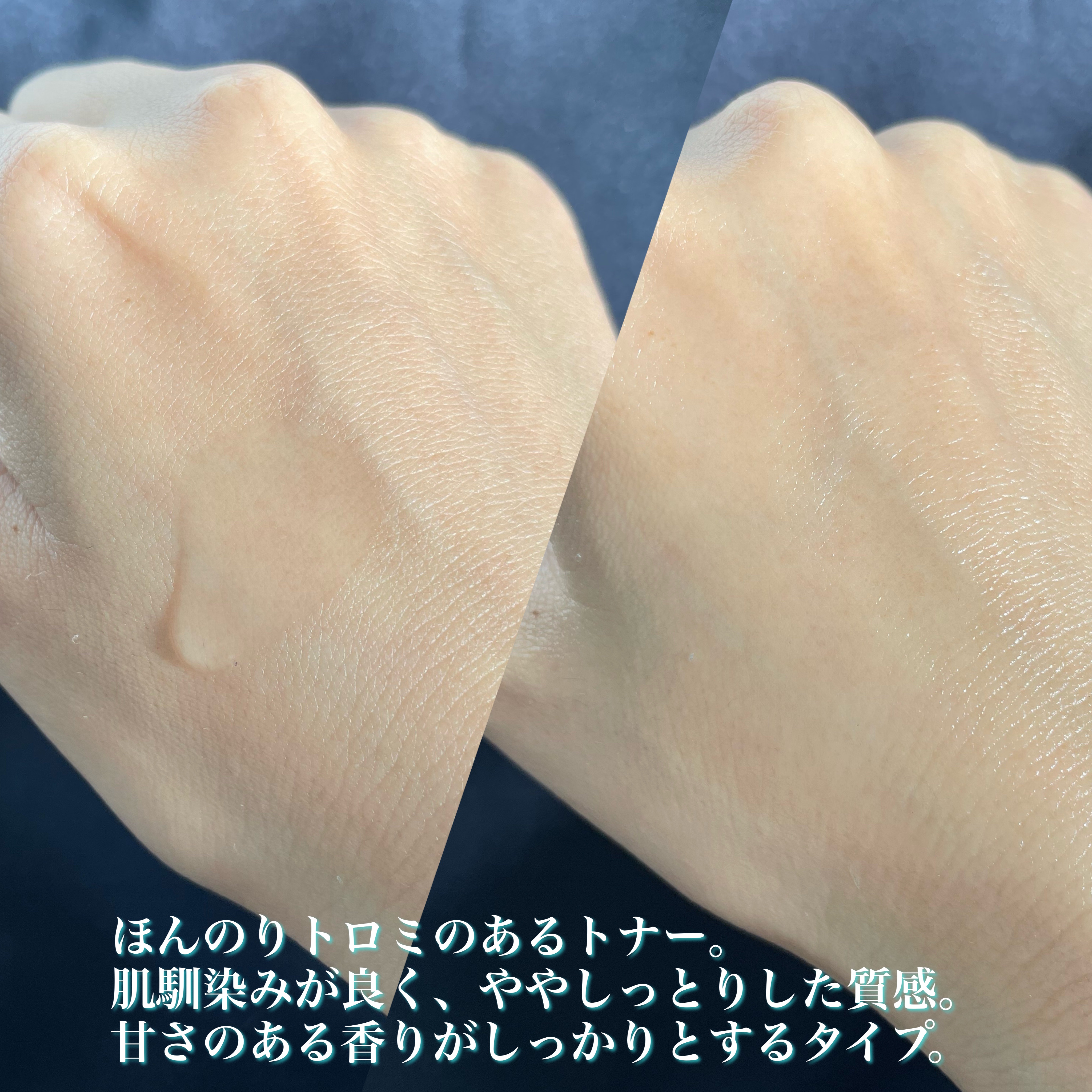 バンブートナー/ASUNE /化粧水を使ったクチコミ（3枚目）