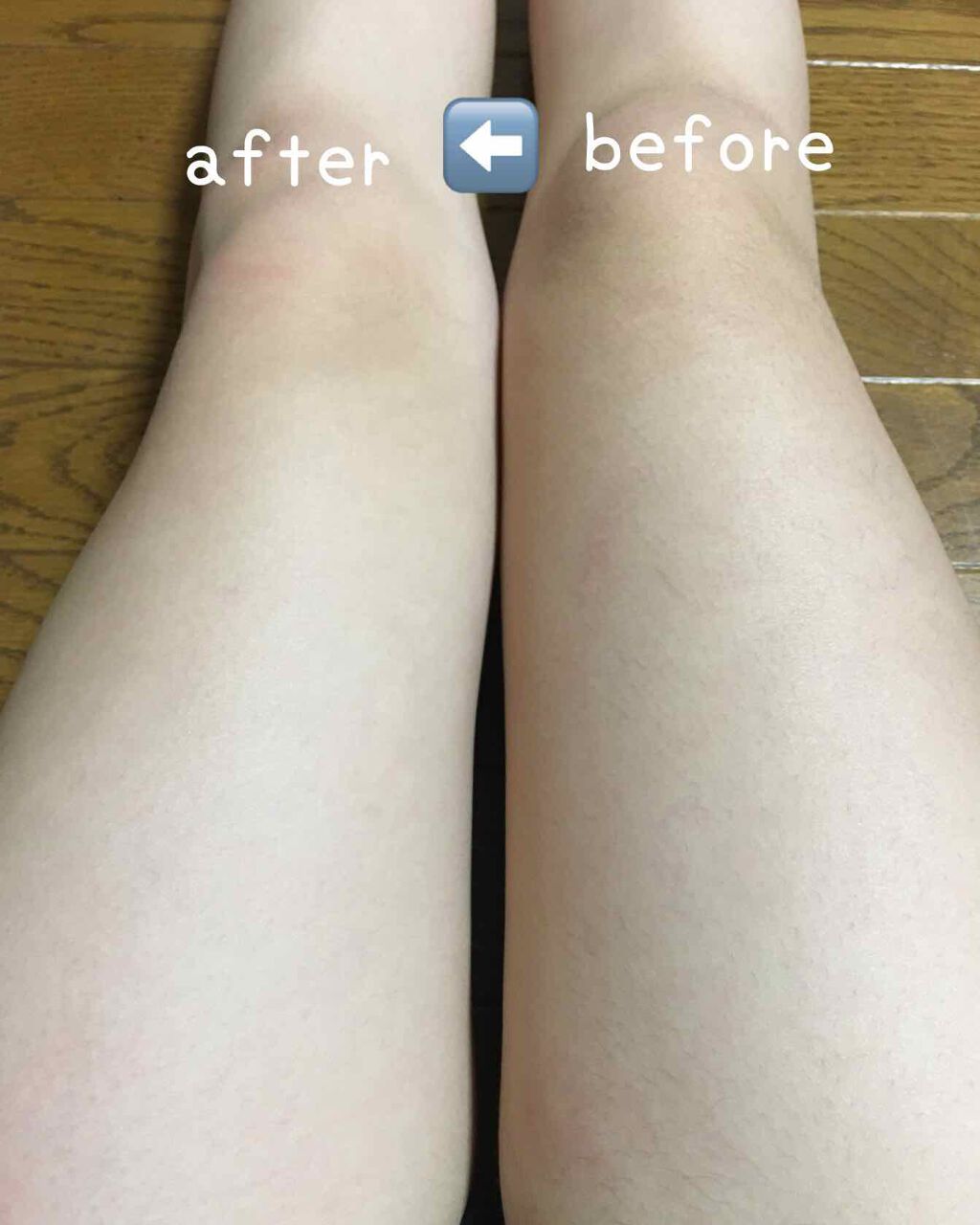 スムーズスキン/DAISO/ムダ毛ケアを使ったクチコミ（2枚目）