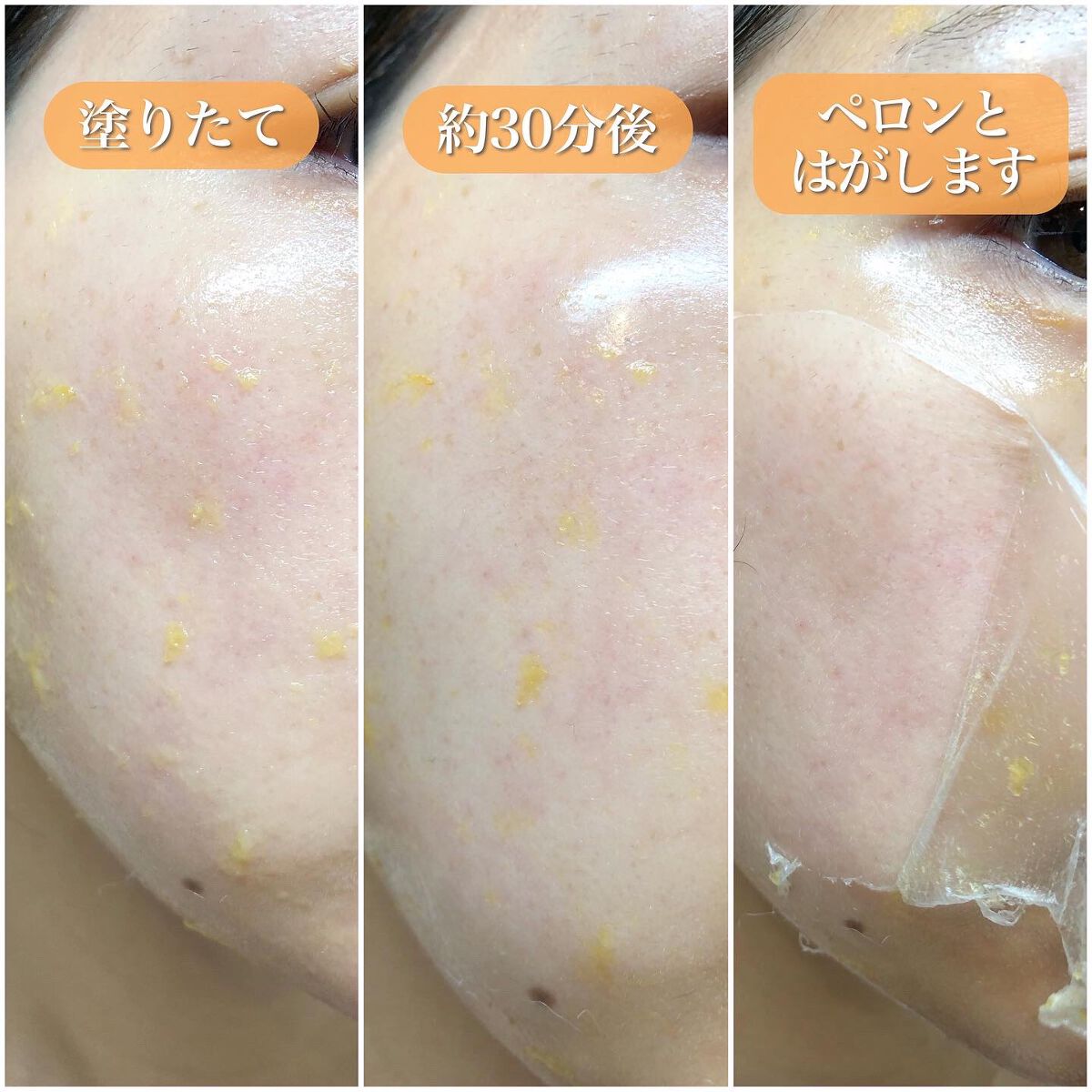 リアルカレンデュラピールオフパック/APRILSKIN/ピーリングを使ったクチコミ(4枚目)