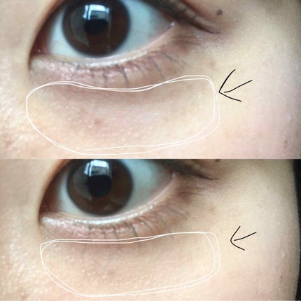 アイゾーンコンシーラー/コフレドール/スティックコンシーラーを使ったクチコミ(3枚目)