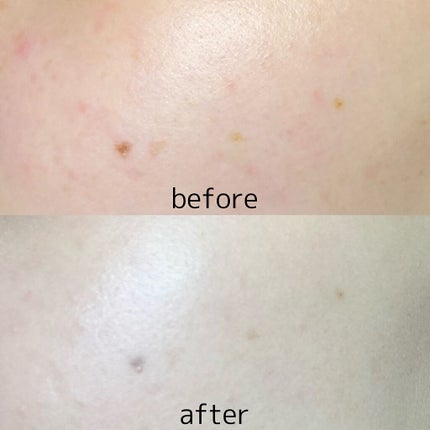 ããŒã»ãã ããŠã㌠ã¯ãã·ã§ã³/innisfree/ã¯ãã·ã§ã³ãã¡ã³ããŒã·ã§ã³ã䜿ã£ãã¯ãã³ãïŒ4æç®ïŒ