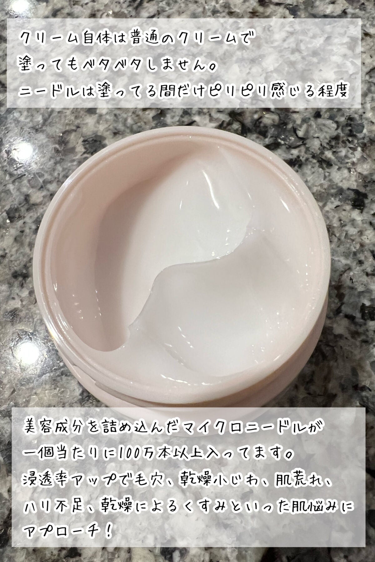 メディリフト ニードルリフトクリーム/YA-MAN TOKYO JAPAN/フェイスクリームを使ったクチコミ(3枚目)