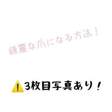 ネイルサポート Na/ネイルネイル/ネイルトップコート・ベースコートを使ったクチコミ（2枚目）