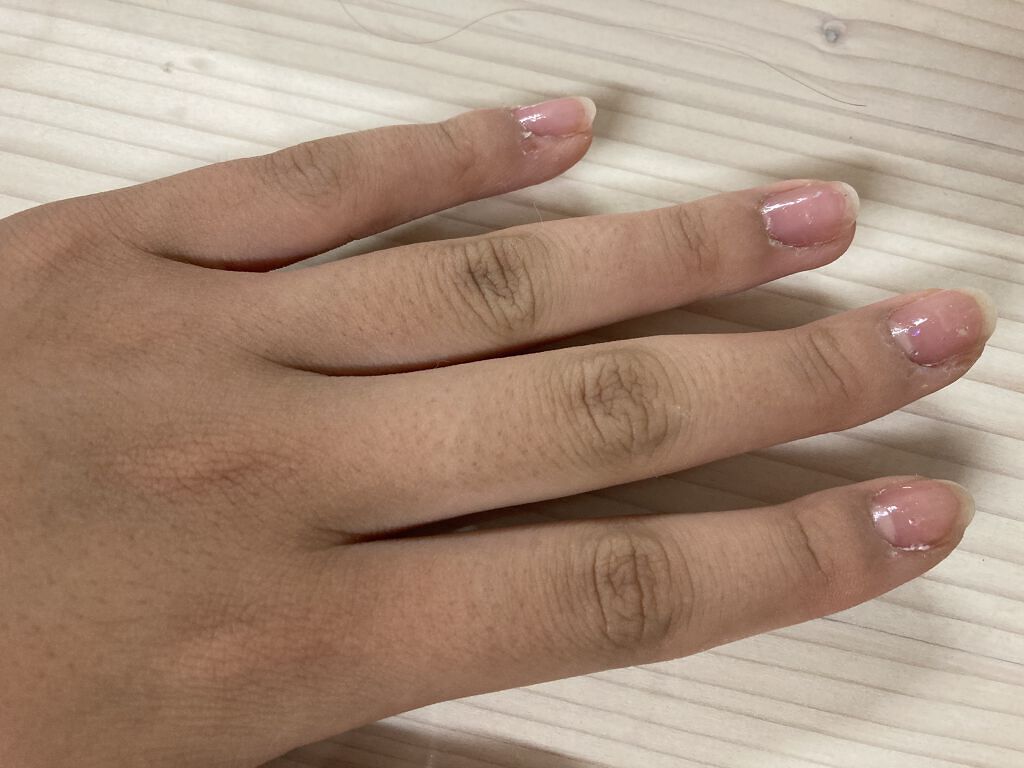 ケアノキュア（医薬品）/小林製薬/その他を使ったクチコミ（2枚目）