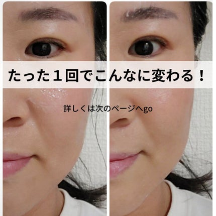 を使ったクチコミ(1枚目)