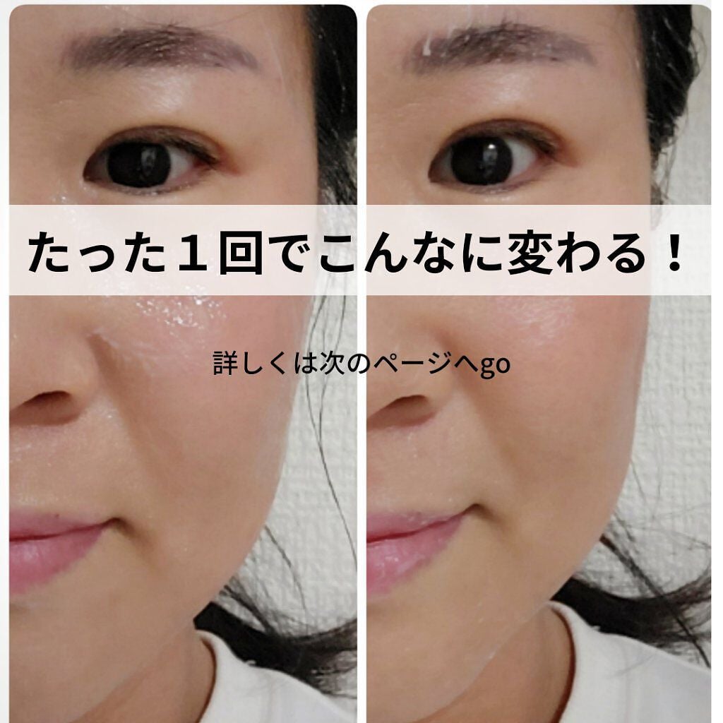美肌カウンセラー💆肌悩みを解決し見る世界を変える on LIPS 「【知らないと損!知ってても使わないと損!】絶対に1度は試してほ..」(4枚目)
