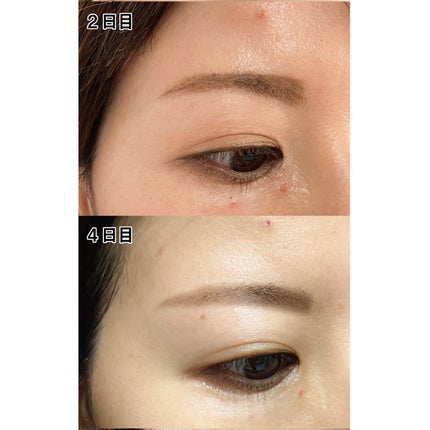 ピュアベール(医薬品)/プロペト/その他を使ったクチコミ(5枚目)