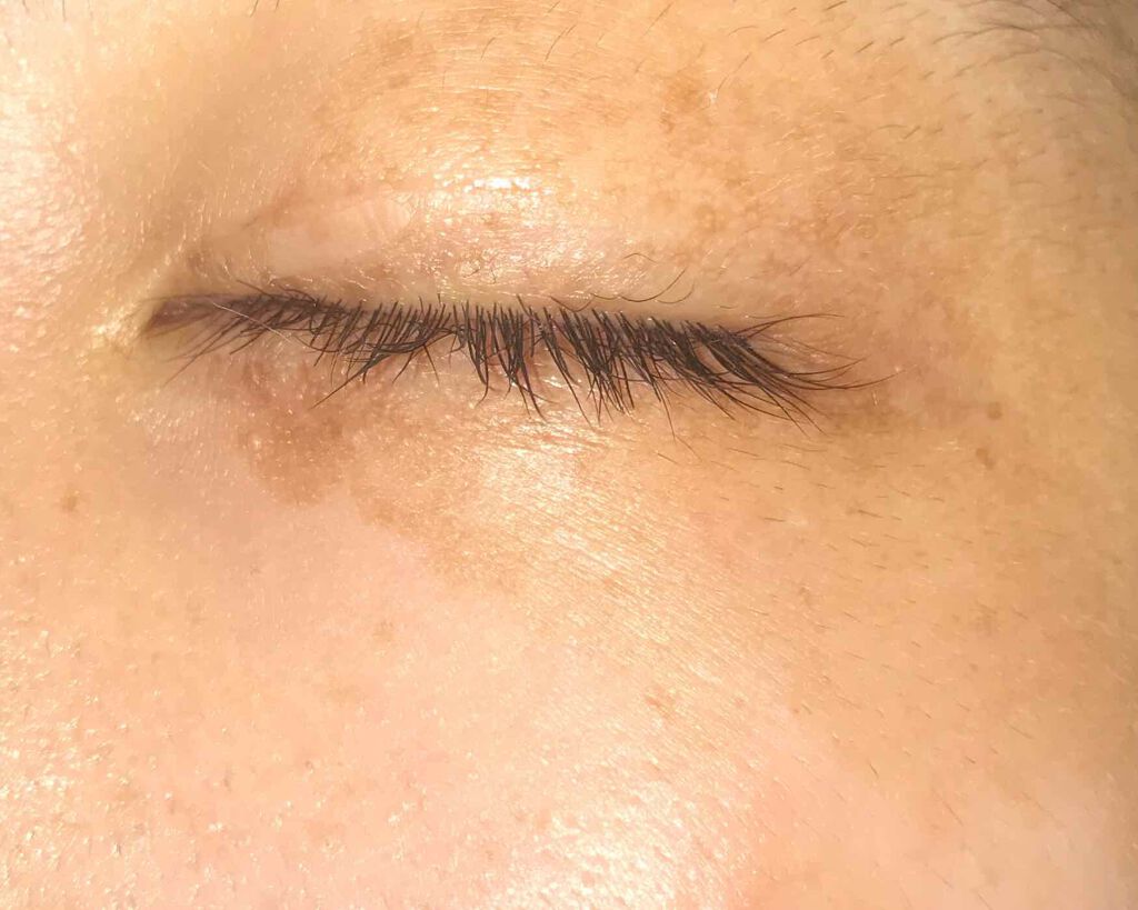 薬用 しみ 集中対策 美容液/メラノCC/美容液を使ったクチコミ(2枚目)