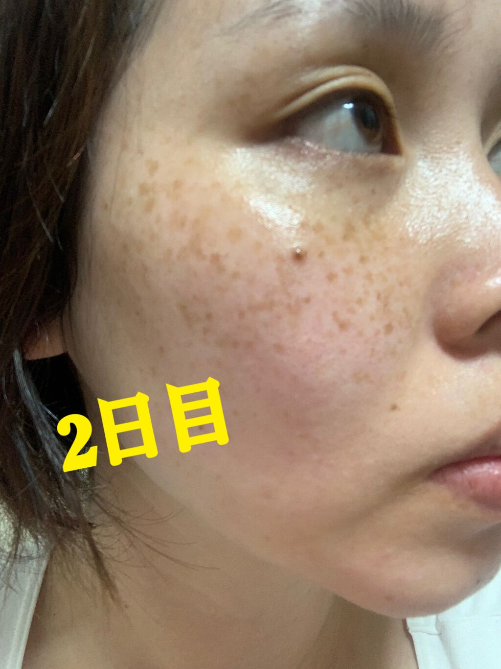 ケシミン クリームj/ケシミン/その他スキンケアを使ったクチコミ(1枚目)