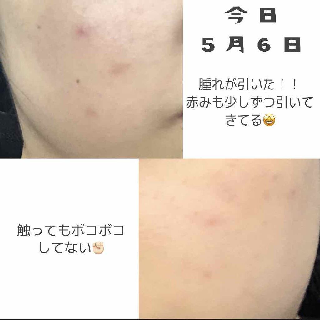 びふナイト/小林薬品/フェイスクリームを使ったクチコミ（3枚目）