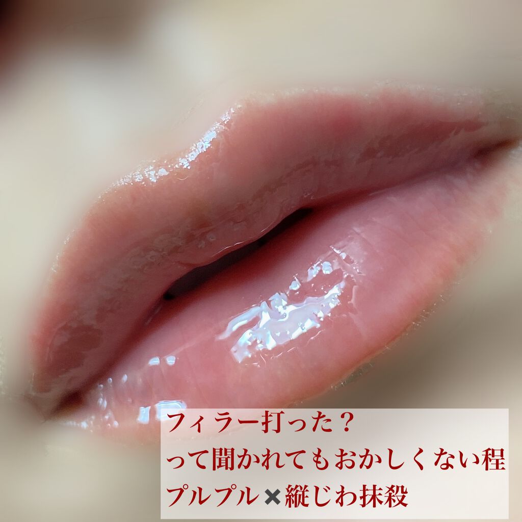 HOTOMI リッププランパー/HOTOMI/リッププランパーを使ったクチコミ（3枚目）