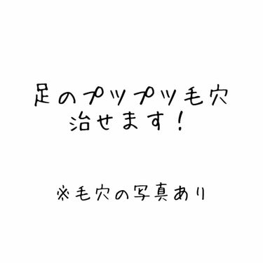 毛穴の画像失礼します😱

でも！私の悩みのひとつだった足のぷつぷつ毛穴がだいぶマシになったんです！！！

LIPSを見てると私と同じように悩んでる方が結構いるんだなって思ったので私が約半年でどうやってこ