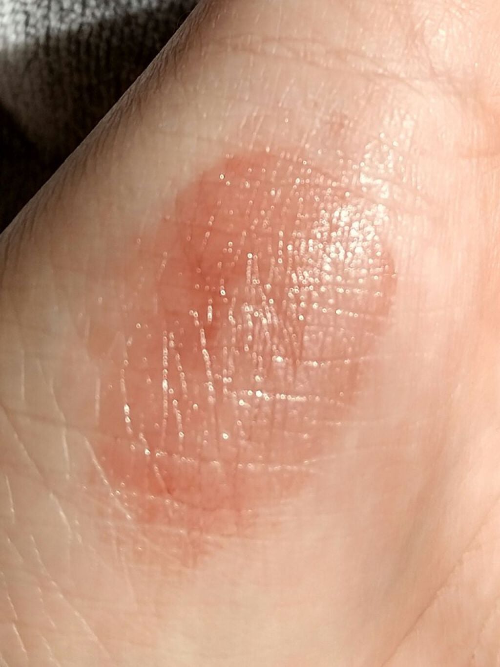 リップ&チーク ボーム N°1 ドゥ シャネル/CHANEL/口紅を使ったクチコミ(5枚目)