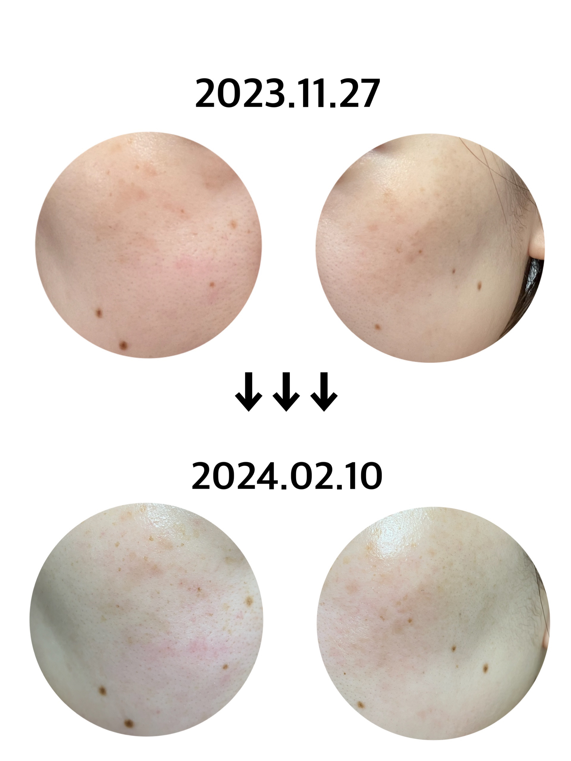 TX-Cream/Dr.Melaxin/フェイスクリームを使ったクチコミ（2枚目）